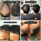Hairline Powder Instantly Covers Hair Loss